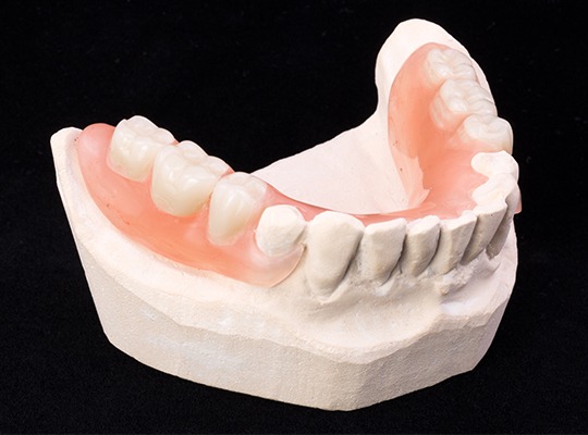 dentures partial denture