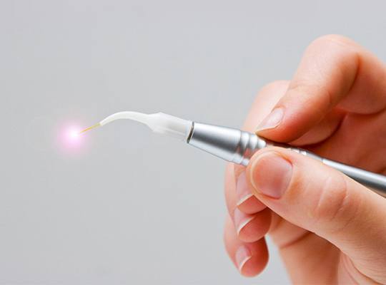 Soft tissue laser hand tool